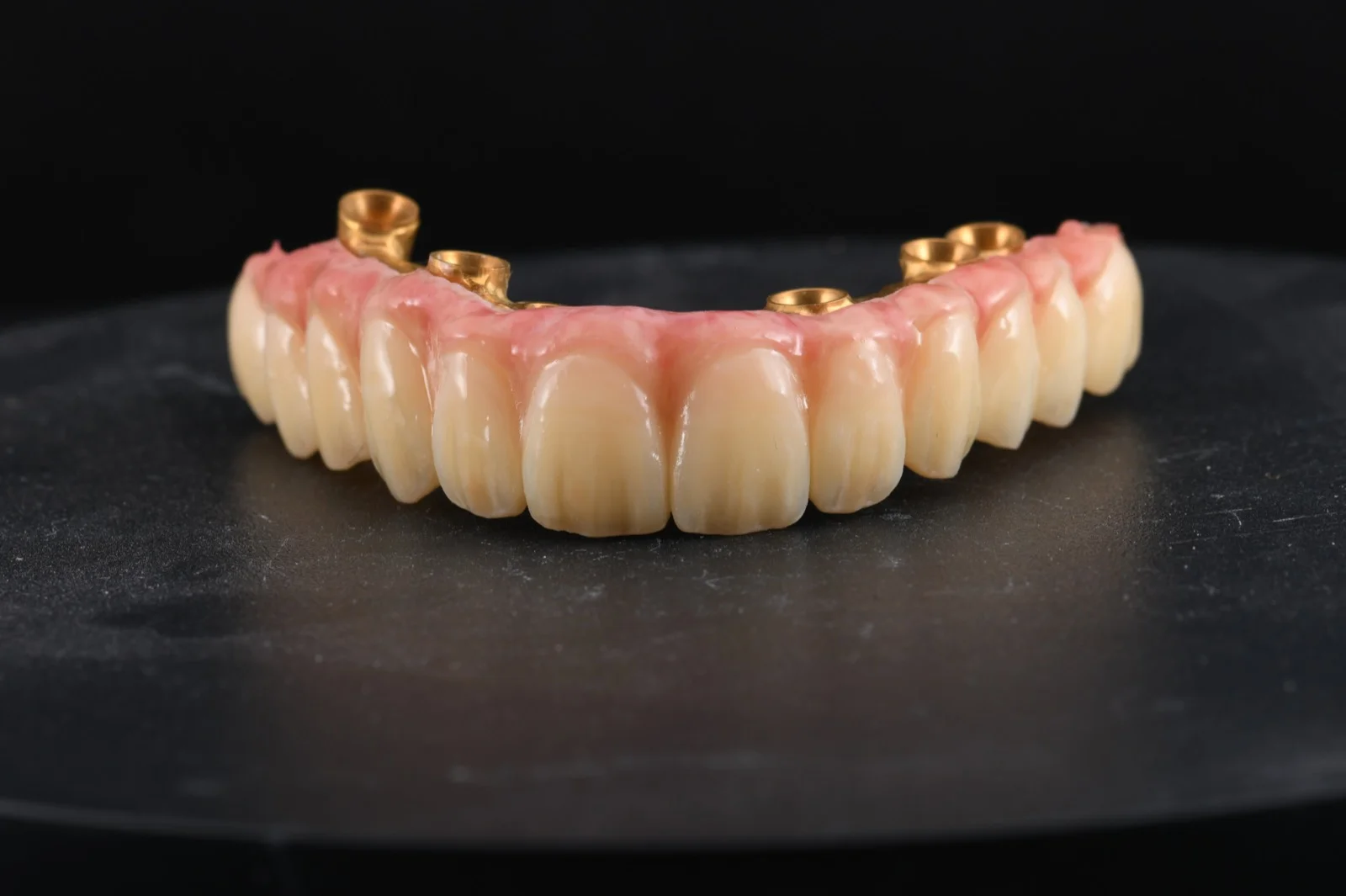 All on 6 PMMA with Composite Gingiva on Anodized Ti Bar 1