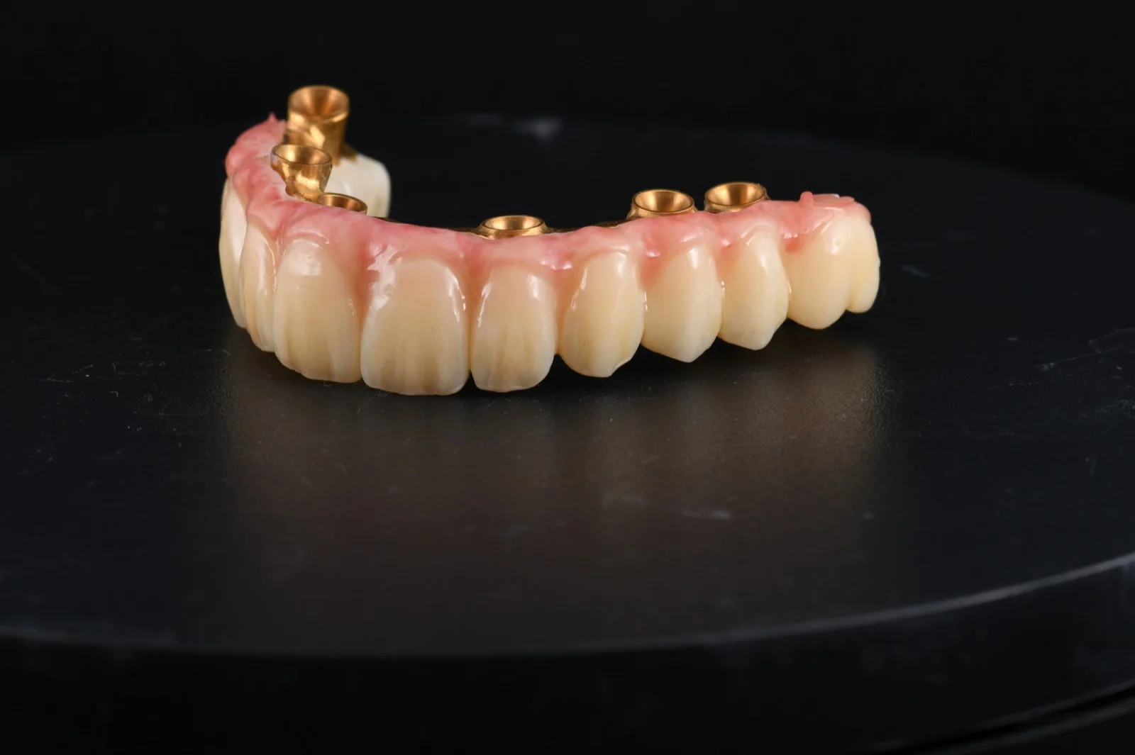 All on 6 PMMA with Composite Gingiva on Anodized Ti Bar 3