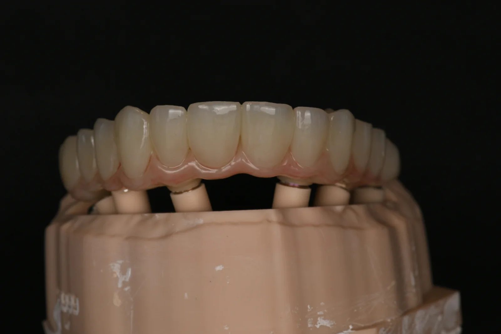 All on 6 Upper Jaw 1