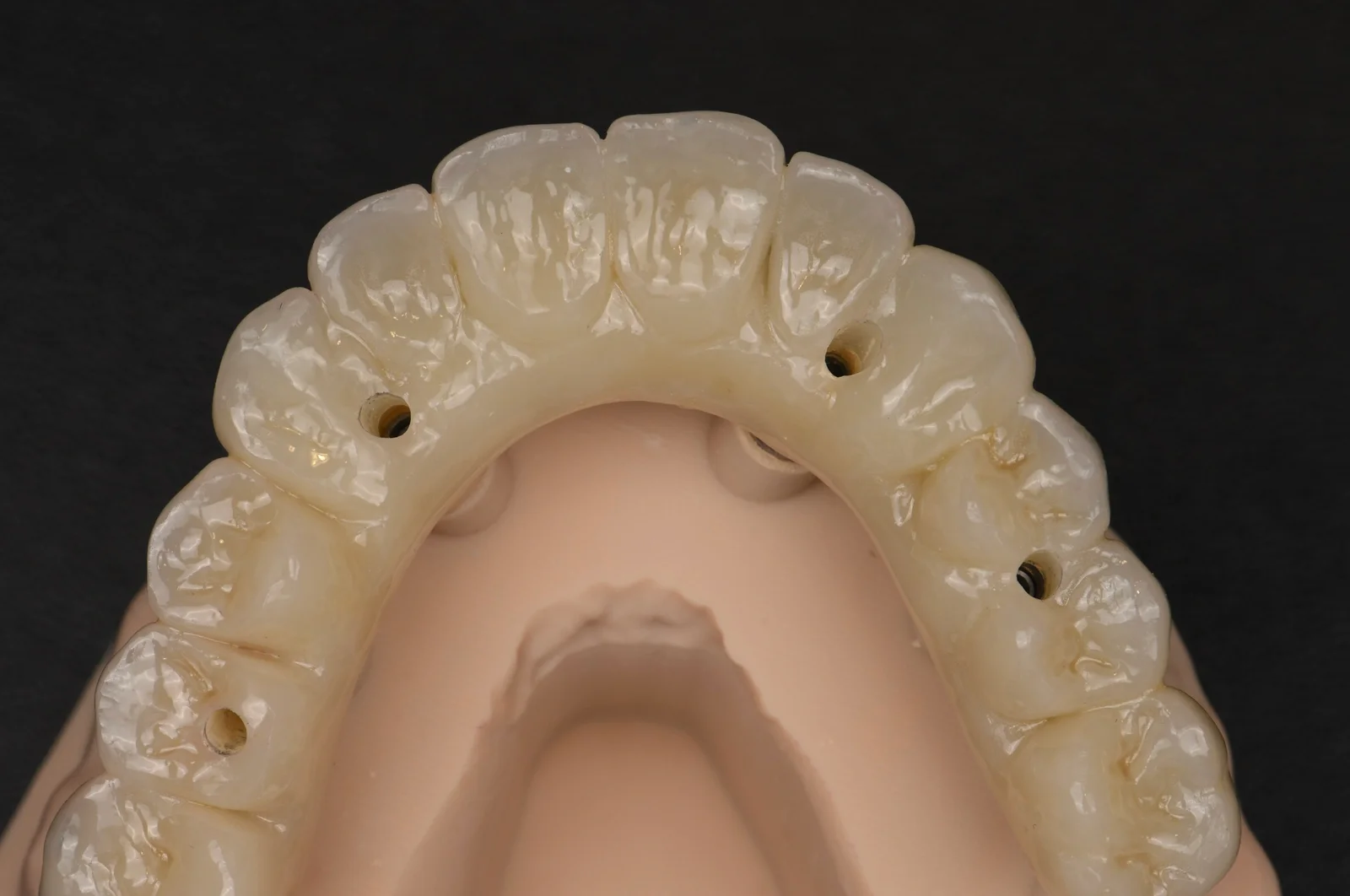 All on 6 Upper Jaw 2