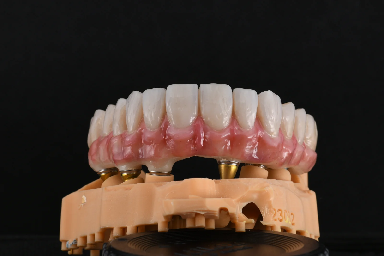 All on X Temporary 1