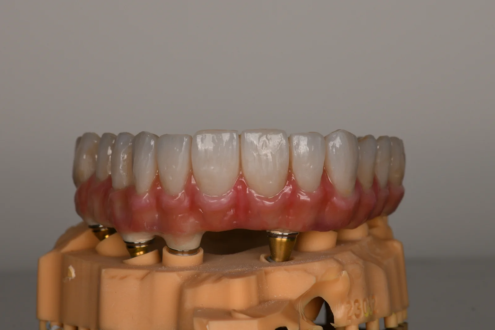 All on X Temporary 2