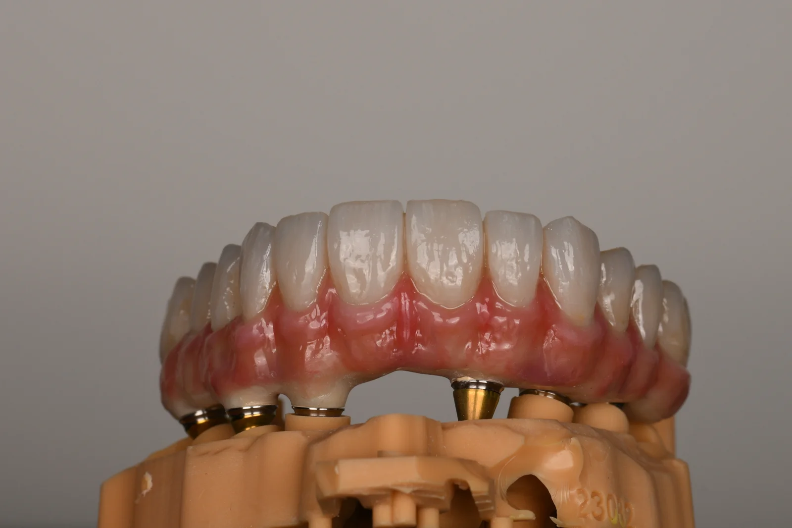 All on X Temporary 3