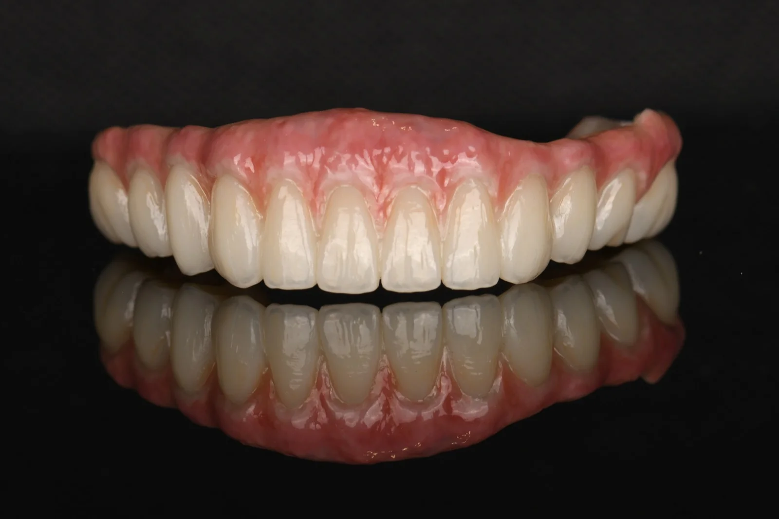 All on X Zirconia on Ti Bar – Lower Arch 2