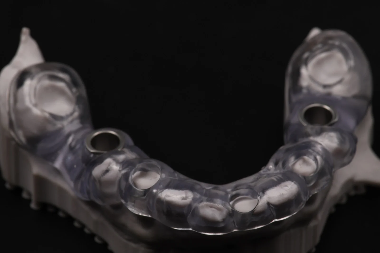 Guided Surgery with Temporary 1