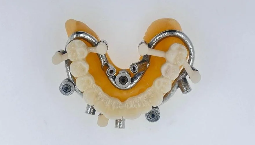 Guided Surgery with Temporary 3