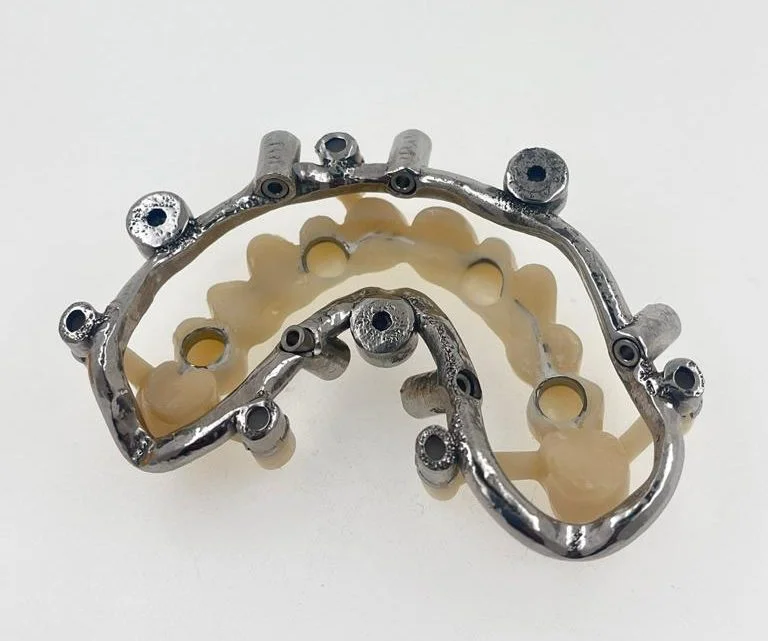 Guided Surgery with Temporary 5